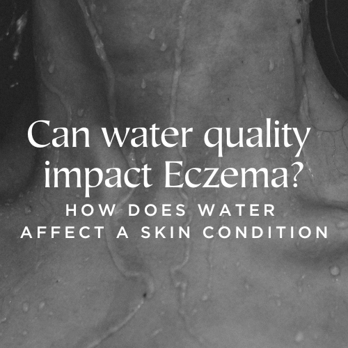 Can water quality impact Eczema?