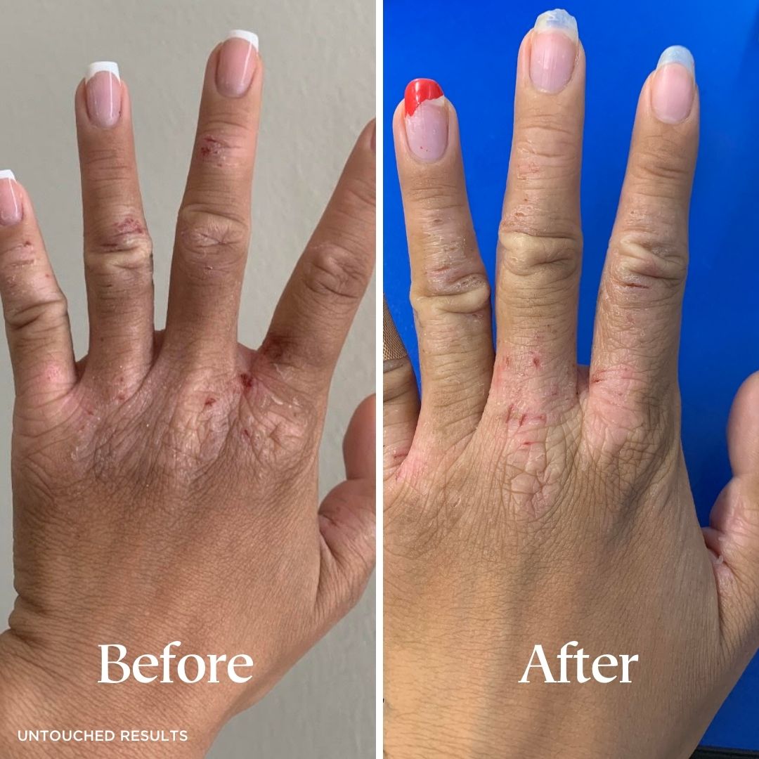 Eczema Care Set - Fragrance Free Body Care Routine