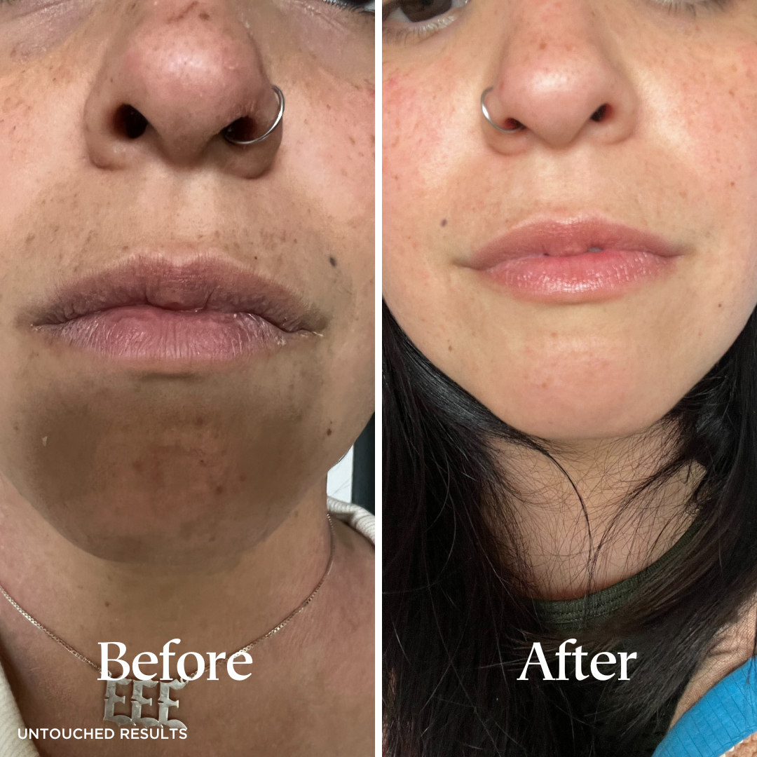 All Moi | Multipurpose Balm