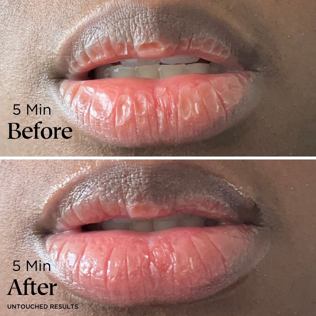 All Moi | Multipurpose Balm