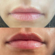 Sade Baron Eczema Care Set - Fragrance Free Body Care Routine *PRE-ORDER* Review