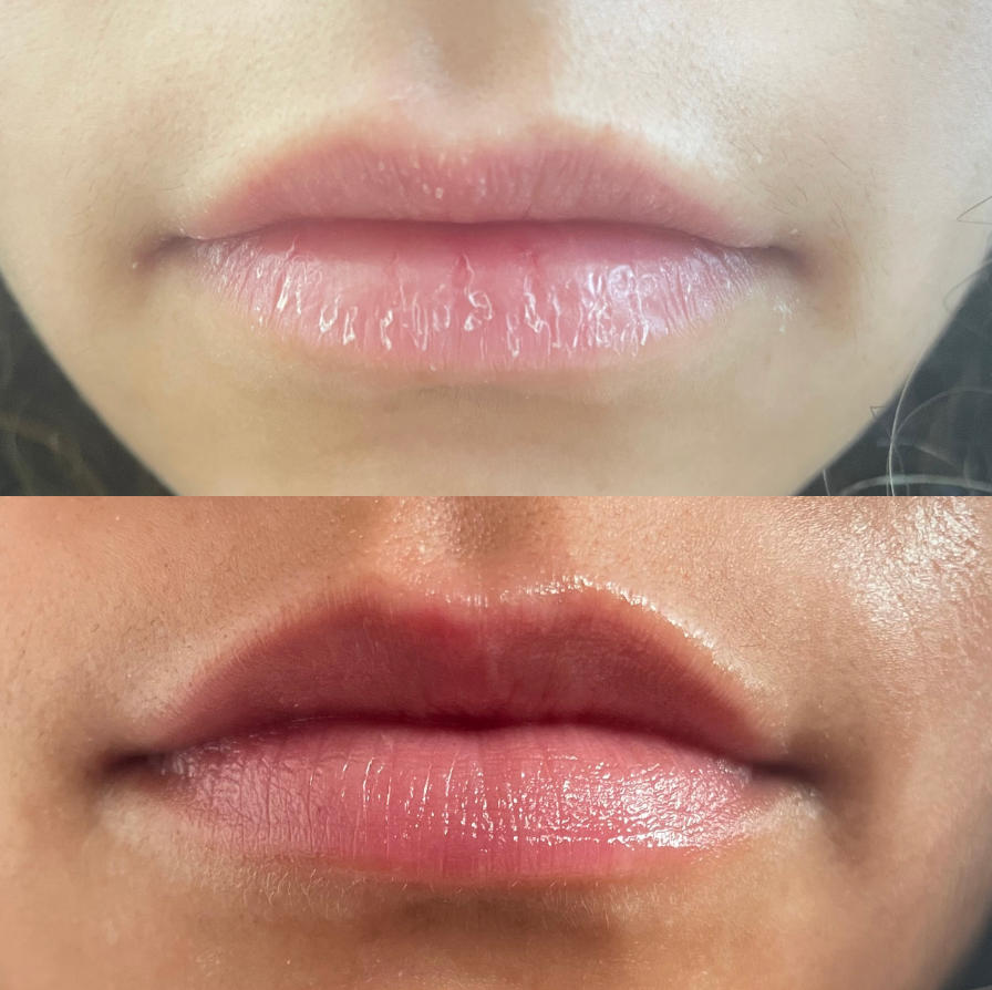 Eczema Care Set - Fragrance Free Body Care Routine - Customer Photo From Isabel